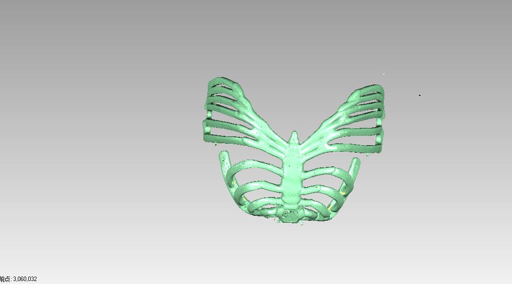 三維掃描儀在醫(yī)療領(lǐng)域的解決方案